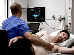 echocardiography