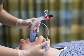 Airway Management Tube