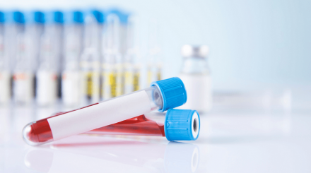 Breast Cancer Liquid Biopsy Market
