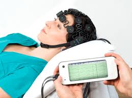 Electroencephalography Devices