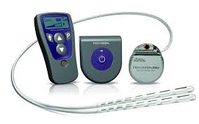Spinal Cord Stimulation Devices